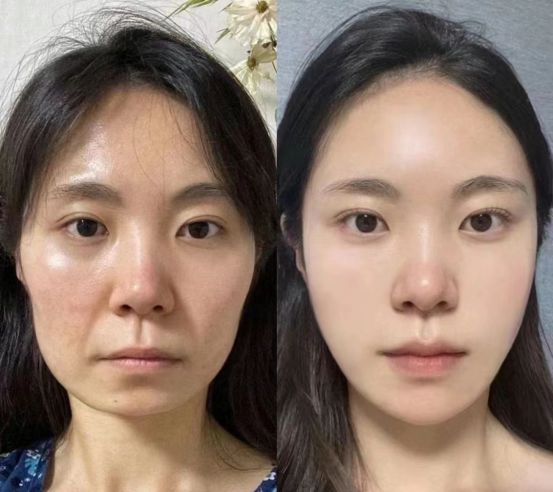 护肤品淡纹紧致肌肤这款我们的最爱K8凯发天生赢家十大最有效抗衰老(图1)