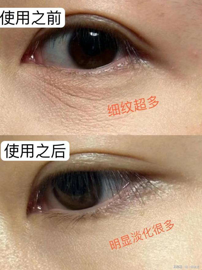效果好？最佳眼霜推荐效果最好的k8凯发一触即发什么眼霜去皱(图1)