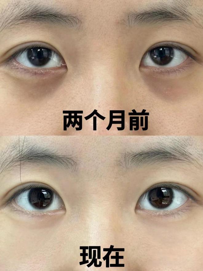 绿管眼霜效果、肤感一流的眼霜解析凯发k8网站广受好评的初源漾小(图1)