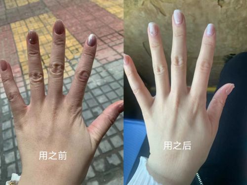 10款护手霜推荐第一名当之无愧！凯发k8登录2025年口碑最好的(图4)